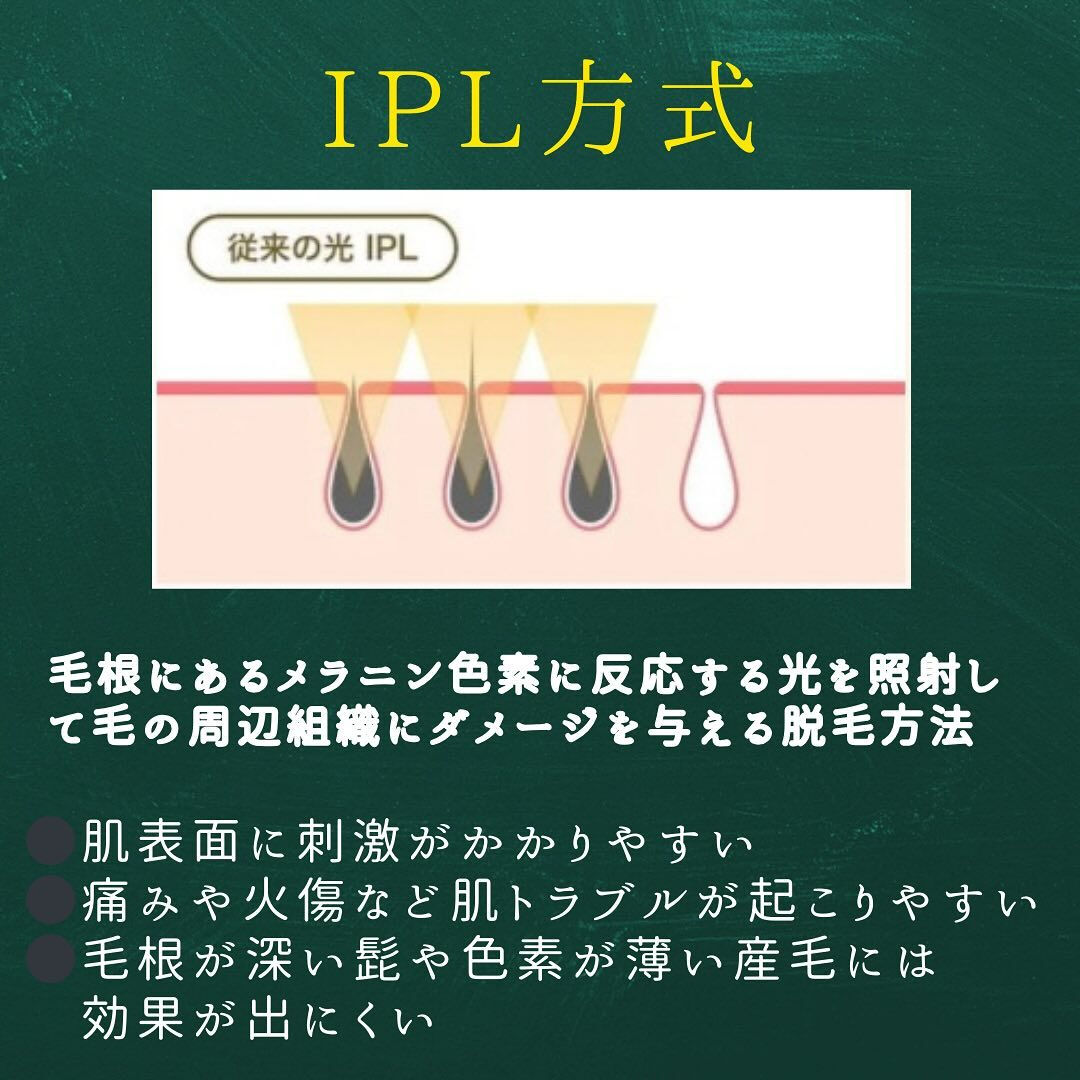 光脱毛のIPL方式とSHR方式の違い