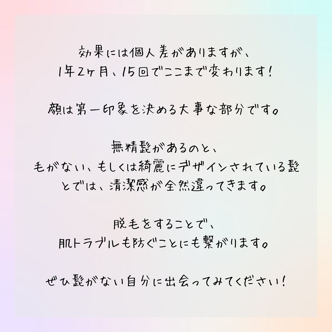 あご髭が15回施術でツルツルに！？