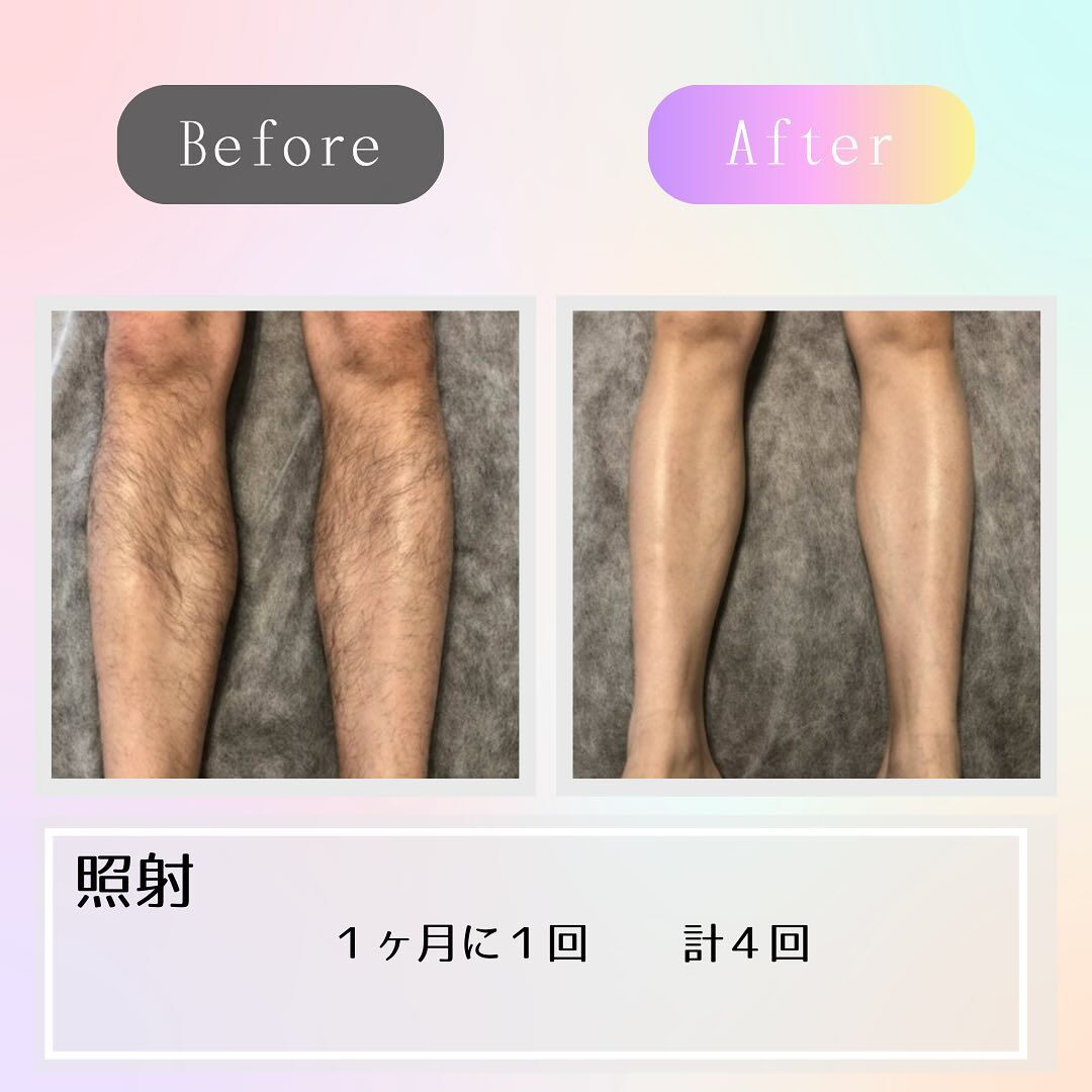 ビフォーアフター