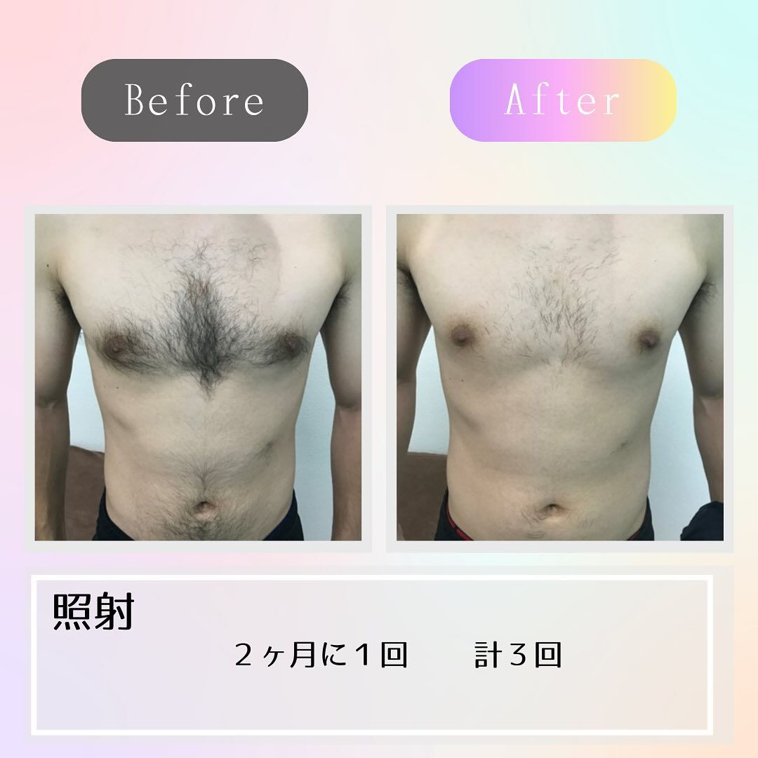 ビフォーアフター