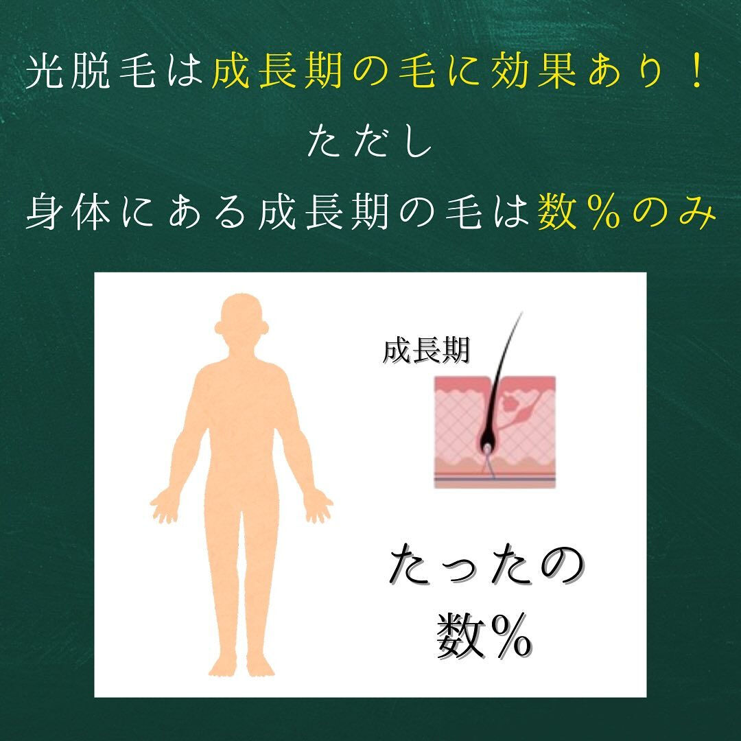光脱毛は通う回数と間隔が大切！