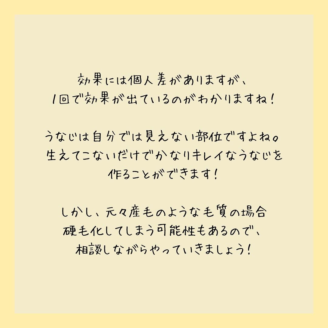 ビフォーアフター