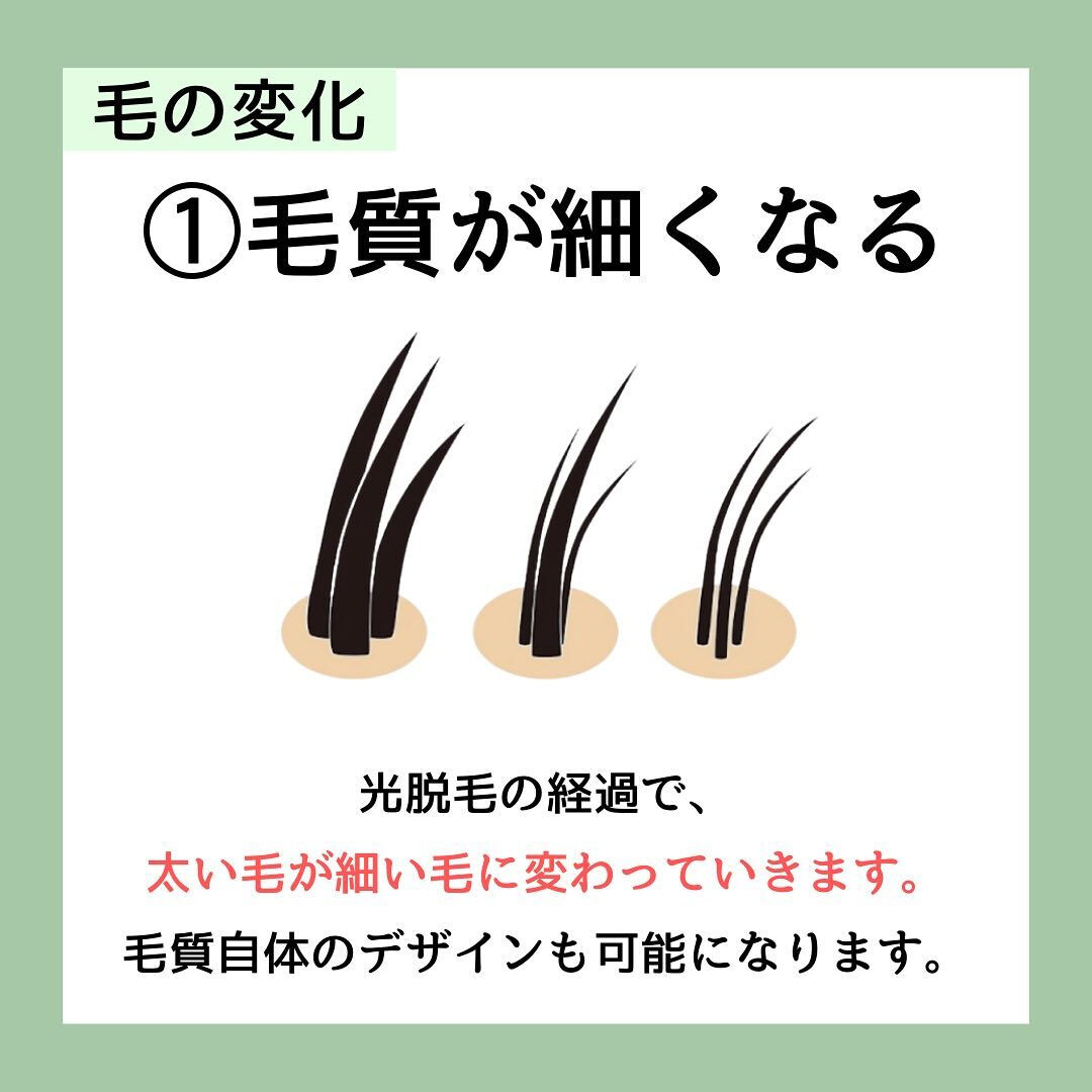 美容脱毛の意外な効果6選