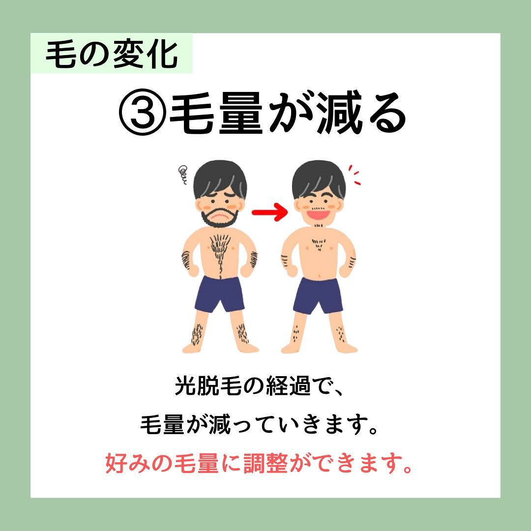 美容脱毛の意外な効果6選