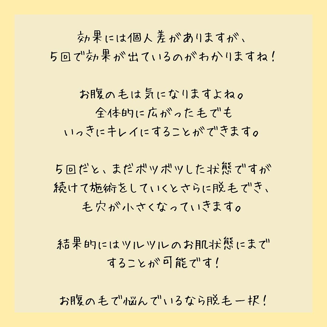 ビフォーアフター