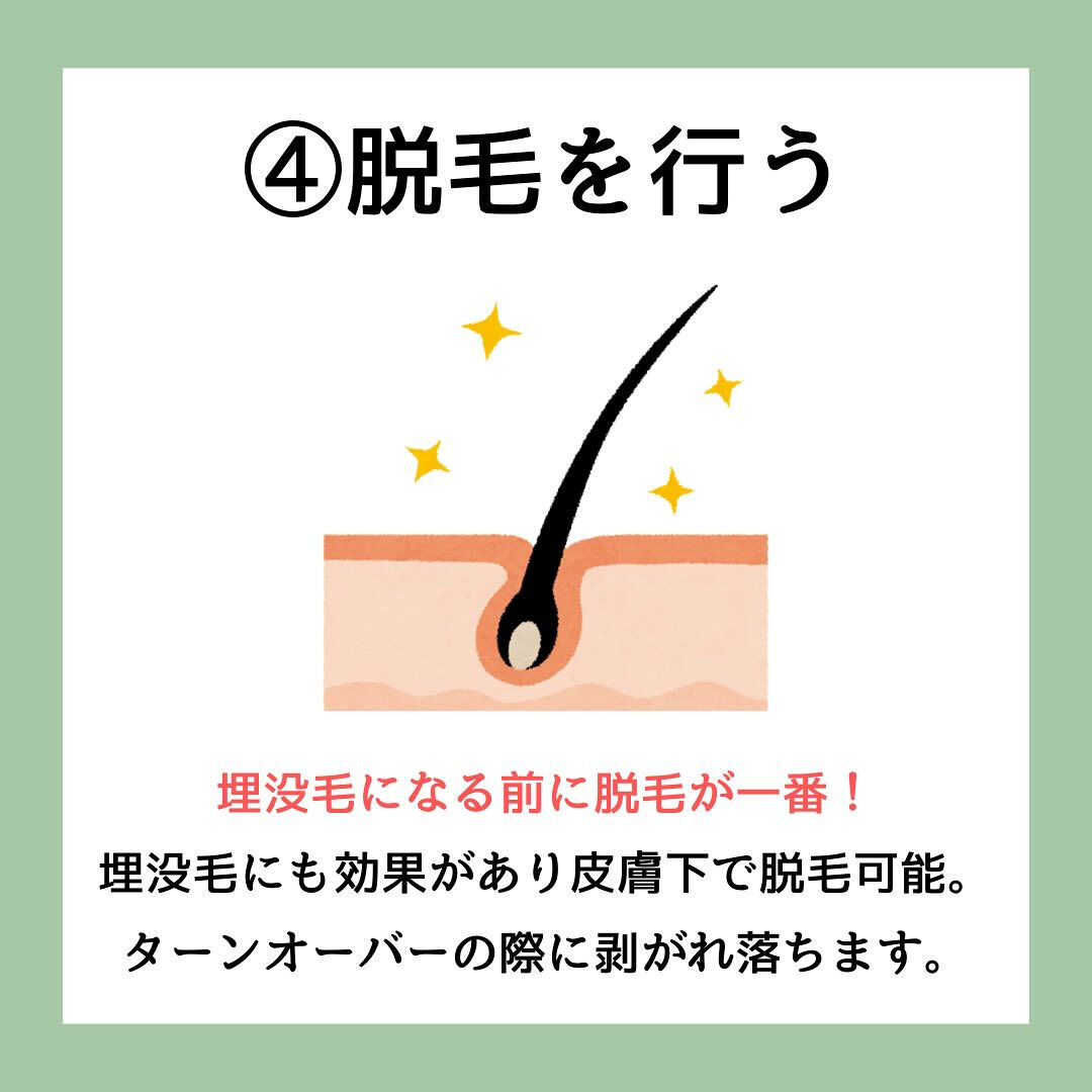 埋没毛の予防方法4選