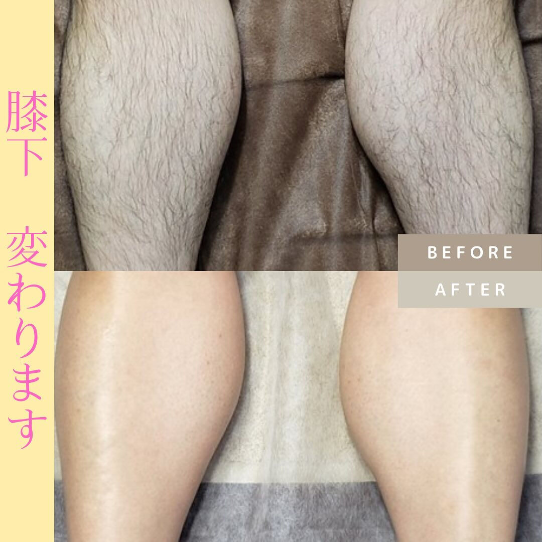 ビフォーアフター