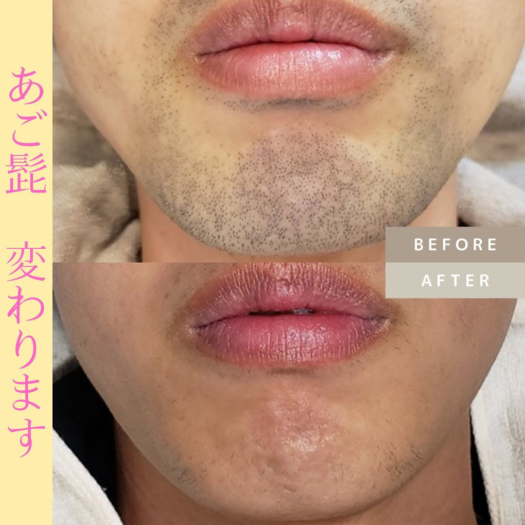 ビフォーアフター