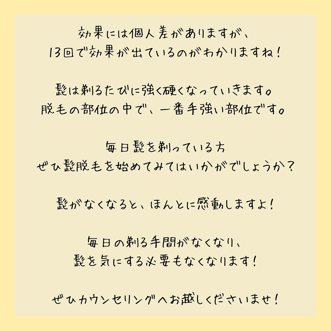 ビフォーアフター