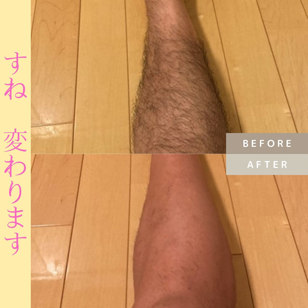 ビフォーアフター