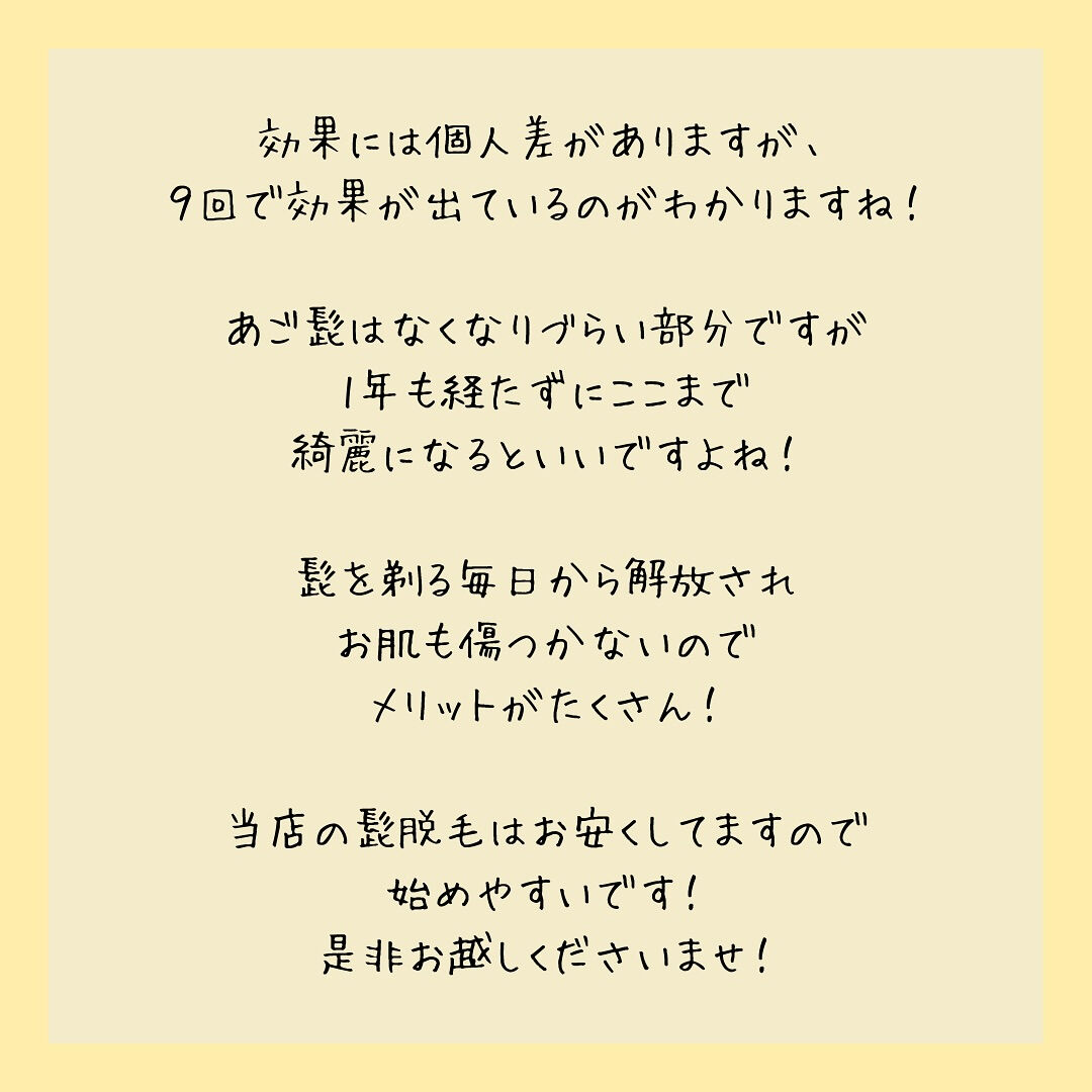 ビフォーアフター