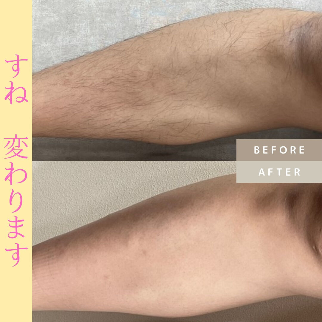 ビフォーアフター