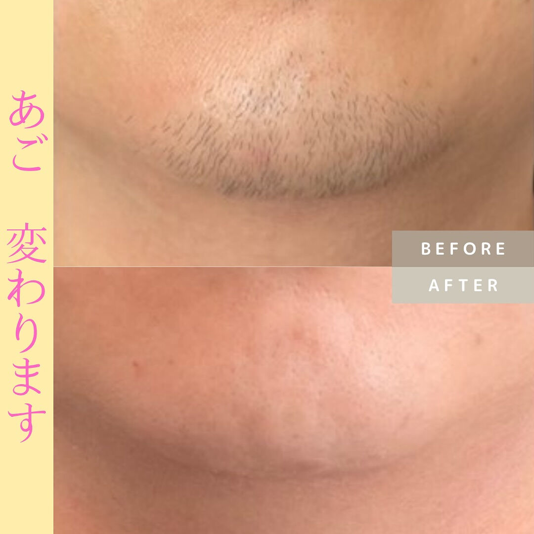 ビフォーアフター