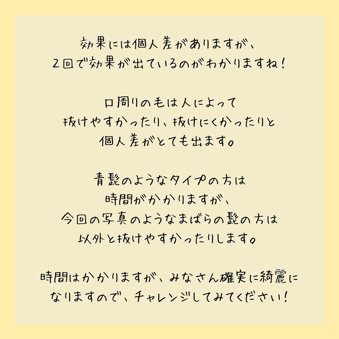 ビフォーアフター