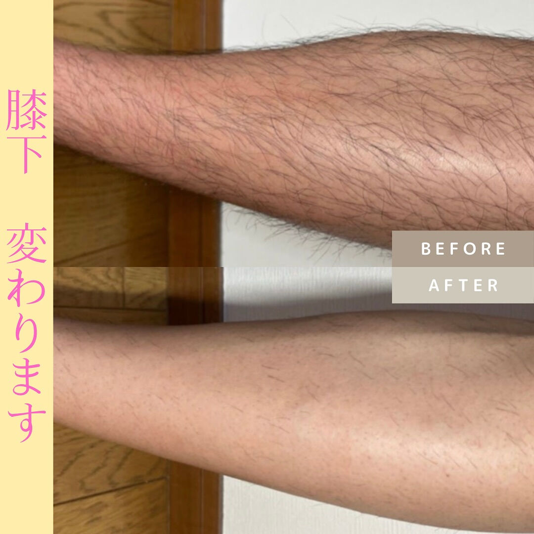 ビフォーアフター