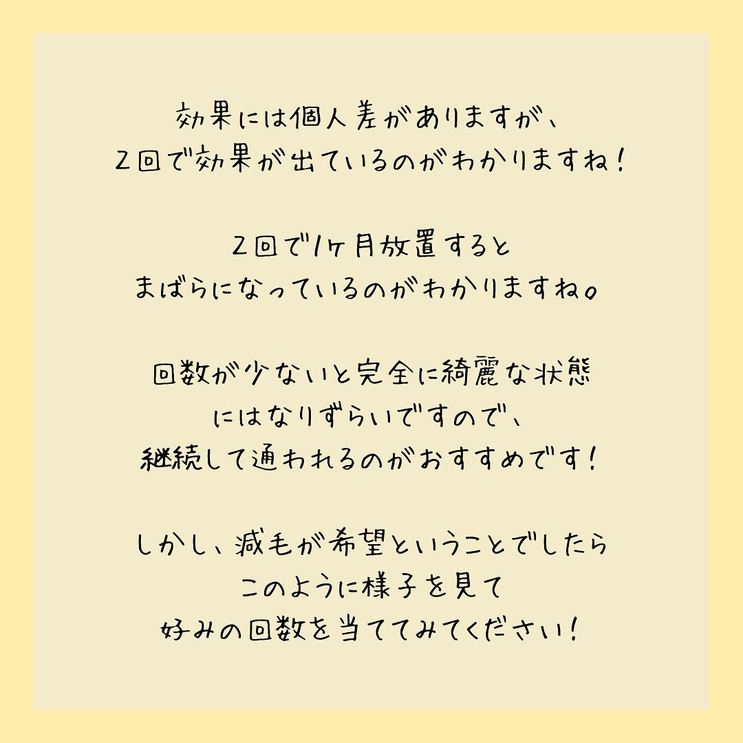 ビフォーアフター